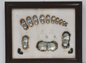 Framed Display - How Cultured Pearls are Formed - 1 month old, 2 years old, Baro Framed Display - How Cultured Pearls are Formed - 1 month old, 2 years old, Baro